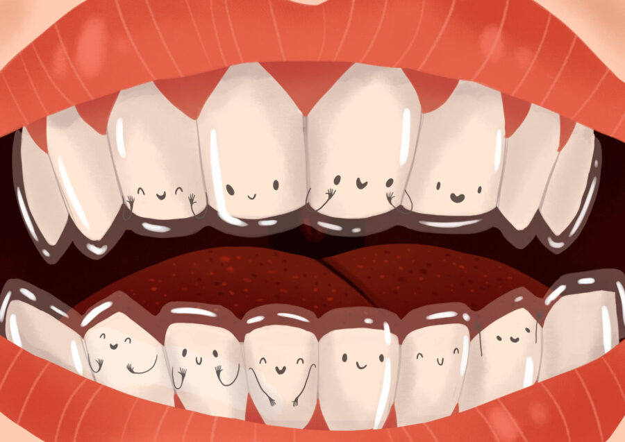 Drawing of a mouth with smiling teeth under retainers after Invisalign clear aligner therapy