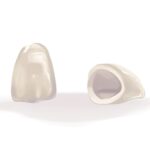 ceramic dental crown, loose dental crown